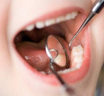 Dentist checking child's tooth-colored fillings in New Britain