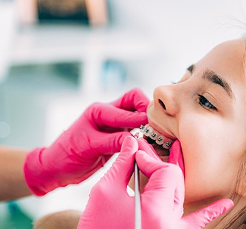 Orthodontist with pink gloves examining child's braces