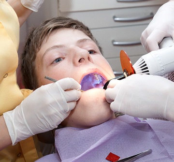 young boy receiving dental sealants