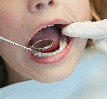 Closeup of child's smile during dental exam