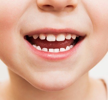 Closeup of child's healthy smile