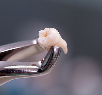 Clasp holding extracted tooth