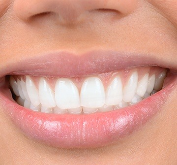 Closeup of healthy smile