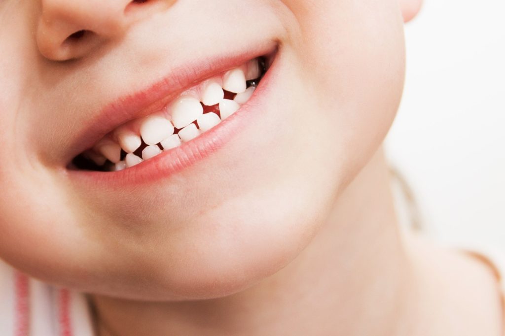 Closeup of child with baby teeth smiling